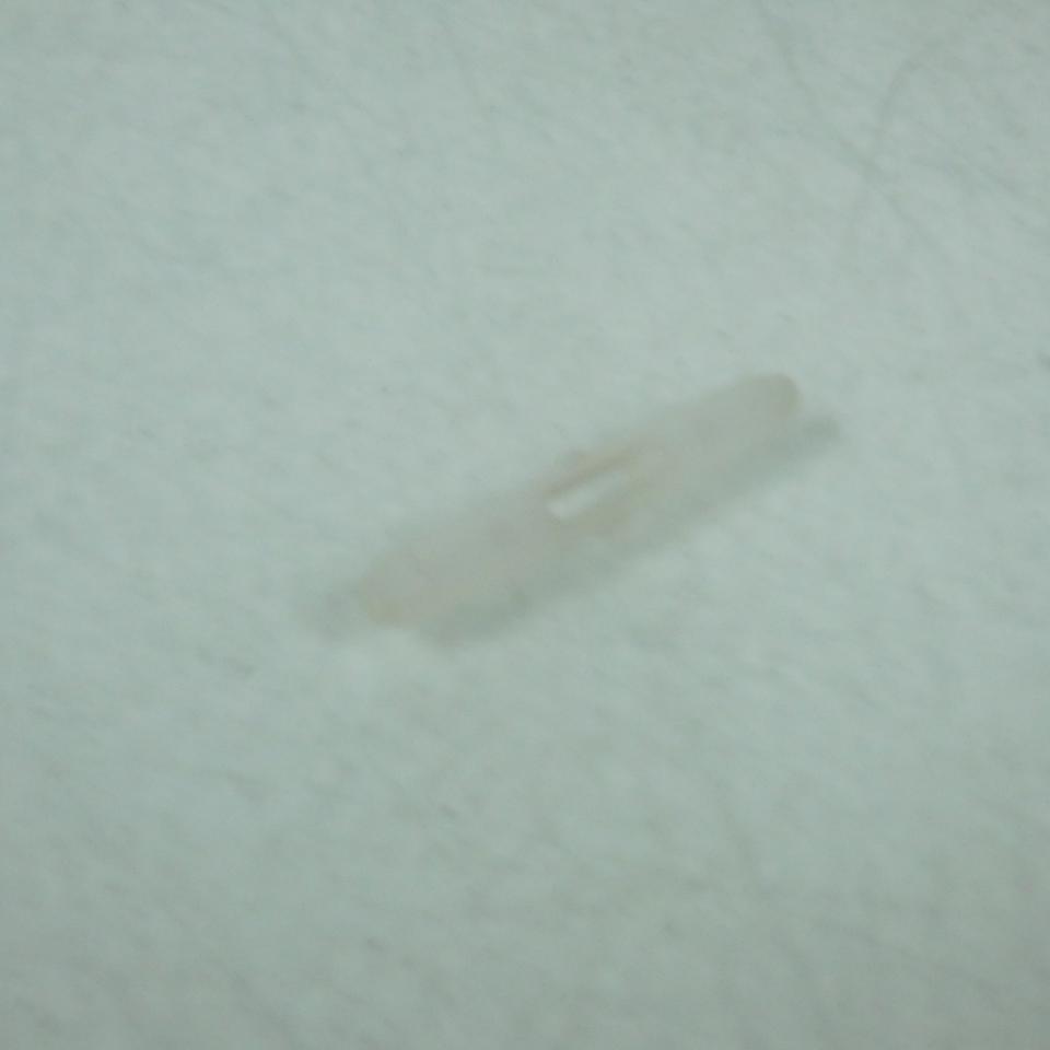 Visserie pour Peugeot 